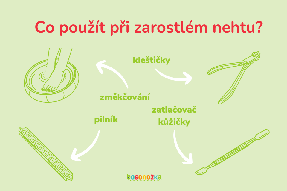 Co použít při zarostlém nehtu_ CZ